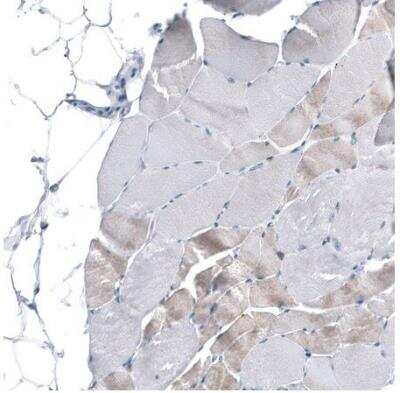 Immunohistochemistry-Paraffin: MS4A6A Antibody [NBP1-86541]