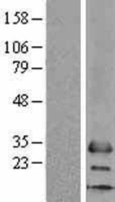 Western Blot: MS4A6A Overexpression Lysate [NBL1-13320]