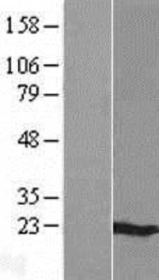 Western Blot: MS4A6A Overexpression Lysate [NBP2-06450]