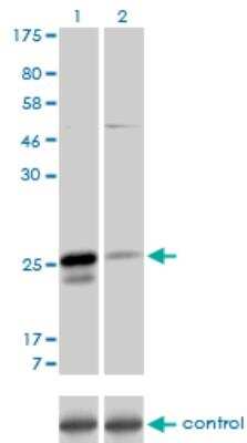 Western Blot: MS4A7 Antibody (2D3) [H00058475-M06]