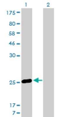 Western Blot: MS4A7 Antibody (2D3) [H00058475-M06]