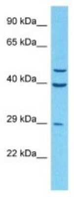 Western Blot: MS4A8A Antibody [NBP3-10205]