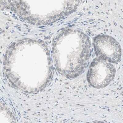 Immunohistochemistry-Paraffin: MS4A8B Antibody [NBP1-81025]