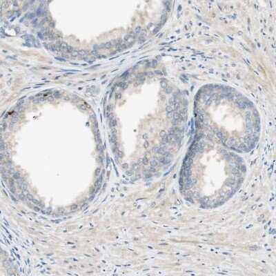 Immunohistochemistry-Paraffin: MS4A8B Antibody [NBP1-81026]