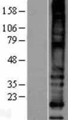 Western Blot: MS4A8B Overexpression Lysate [NBP2-04399]