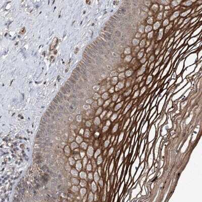 Immunohistochemistry: MSANTD2 Antibody [NBP2-38427]