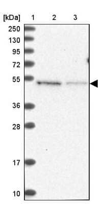 Western Blot: MSANTD2 Antibody [NBP1-93931]