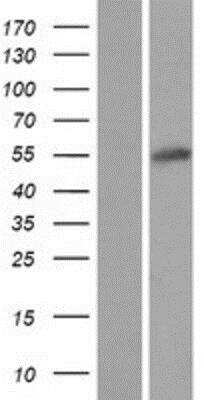 Western Blot: MSANTD2 Overexpression Lysate [NBP2-06293]