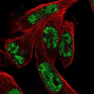 Immunocytochemistry/ Immunofluorescence: MSANTD3 Antibody [NBP2-57629]