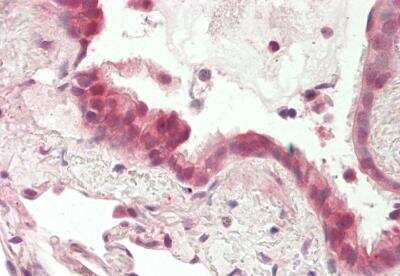 Immunohistochemistry-Paraffin: MSANTD3 Antibody [NBP2-87845]
