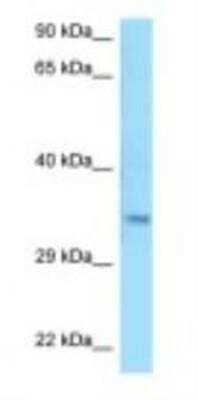 Western Blot: MSANTD3 Antibody [NBP1-98441]