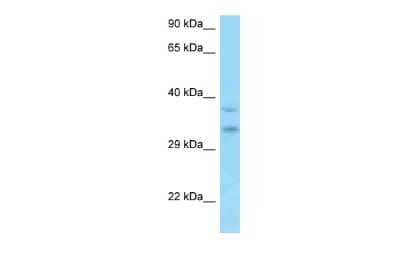 Western Blot: MSANTD3 Antibody [NBP2-87845]