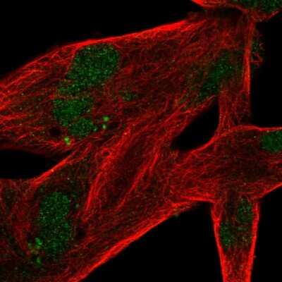 Immunocytochemistry/ Immunofluorescence: MSANTD4 Antibody [NBP2-30663]