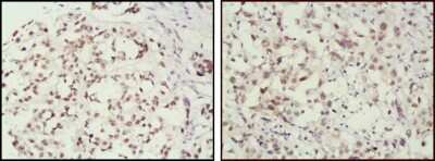 Immunohistochemistry-Paraffin: MSH2 Antibody (1B3) - BSA Free [NB100-1767]