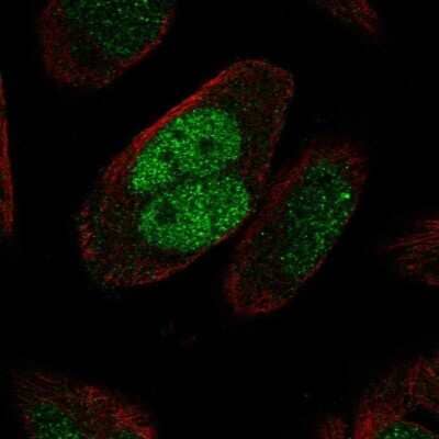 Immunocytochemistry/ Immunofluorescence: MSH2 Antibody [NBP2-68845]