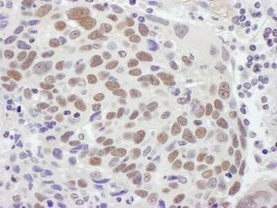 Immunohistochemistry-Paraffin: MSH2 Antibody [NB100-621]