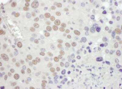 Immunohistochemistry-Paraffin: MSH2 Antibody [NB100-621]