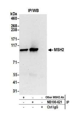 Immunoprecipitation: MSH2 Antibody [NB100-621]