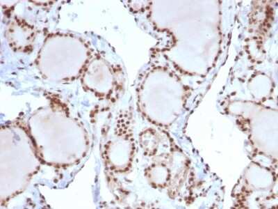 Immunohistochemistry-Paraffin: MSH2 Antibody (MSH2/2622) - Azide and BSA Free [NBP3-08957]