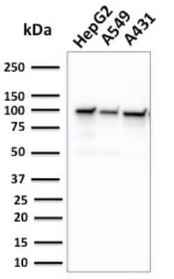 Western Blot: MSH2 Antibody (MSH2/2622)Azide and BSA Free [NBP3-08957]