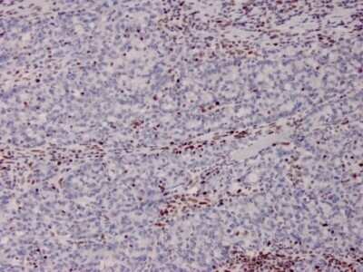 Immunohistochemistry-Paraffin: MSH2 Antibody (MSH2/2622) [NBP3-07211]