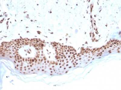 Immunohistochemistry-Paraffin: MSH2 Antibody (MSH2/2622) [NBP3-07211]