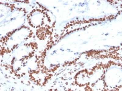 Immunohistochemistry-Paraffin: MSH2 Antibody (MSH2/2622) [NBP3-07211]