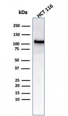 Western Blot: MSH2 Antibody (MSH2/6549R)Azide and BSA Free [NBP3-08958]