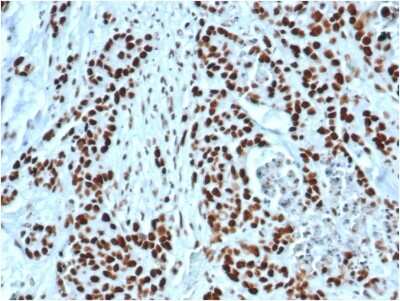 Immunohistochemistry-Paraffin: MSH2 Antibody (MSH2/6549R) [NBP3-07212]