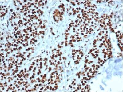 Immunohistochemistry-Paraffin: MSH2 Antibody (MSH2/6549R) [NBP3-07212]