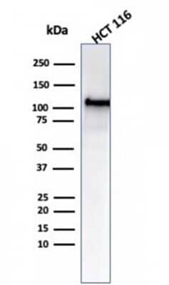 Western Blot: MSH2 Antibody (MSH2/6549R) [NBP3-07212]