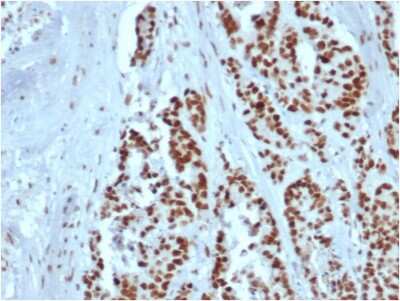 Immunohistochemistry-Paraffin: MSH2 Antibody (rMSH2/6548) - Azide and BSA Free [NBP3-08956]