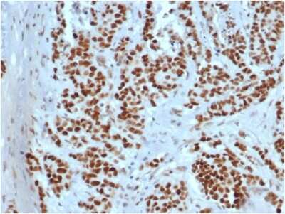 Immunohistochemistry-Paraffin: MSH2 Antibody (rMSH2/6548) [NBP3-07210]