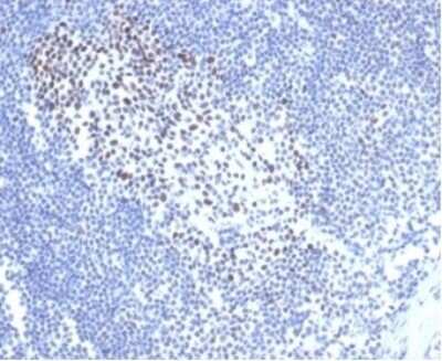 Immunohistochemistry-Paraffin: MSH2 Antibody (rMSH2/6548) [NBP3-07210]