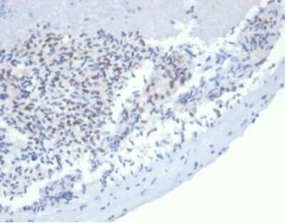 Immunohistochemistry-Paraffin: MSH2 Antibody (rMSH2/6548) [NBP3-07210]
