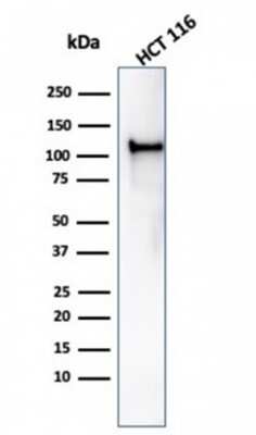 Western Blot: MSH2 Antibody (rMSH2/6548) [NBP3-07210]