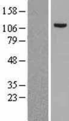 Western Blot: MSH2 Overexpression Lysate [NBL1-13325]