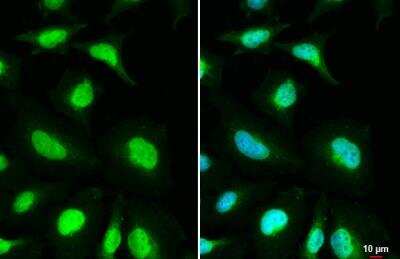 Immunocytochemistry/ Immunofluorescence: MSH3 Antibody [NBP2-19417]