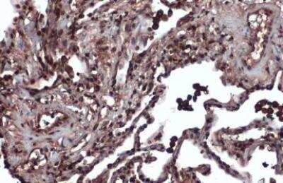 Immunohistochemistry-Paraffin: MSH3 Antibody [NBP2-19417]