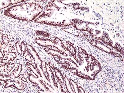 Immunohistochemistry-Paraffin: MSH3 Antibody (RM405) [NBP2-89099]