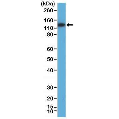 Western Blot: MSH3 Antibody (RM405) [NBP2-89099]