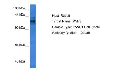 Western Blot: MSH3 Antibody [NBP2-86714]