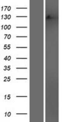 Western Blot: MSH3 Overexpression Lysate [NBP2-08115]