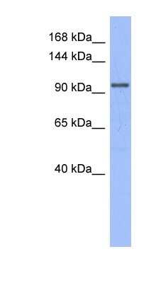 Western Blot: MSH4 Antibody [NBP1-58170]