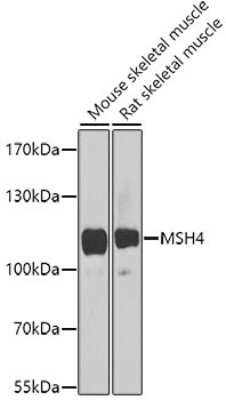 Western Blot: MSH4 AntibodyBSA Free [NBP2-94754]