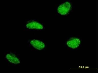 Immunocytochemistry/ Immunofluorescence: MSH5 Antibody (1C11) [H00004439-M08]