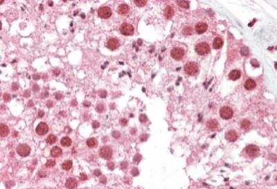 Immunohistochemistry-Paraffin: MSH5 Antibody [NBP1-20946]