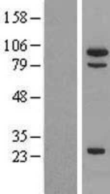 Western Blot: MSH5 Overexpression Lysate [NBL1-13327]