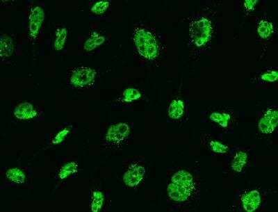 Immunocytochemistry/ Immunofluorescence: MSH6 Antibody (021) [NBP2-89318]