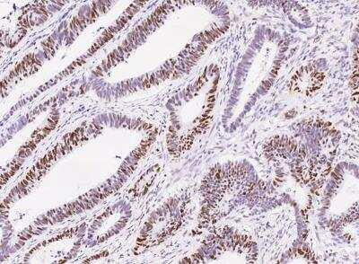 Immunohistochemistry-Paraffin: MSH6 Antibody (021) [NBP2-89318]